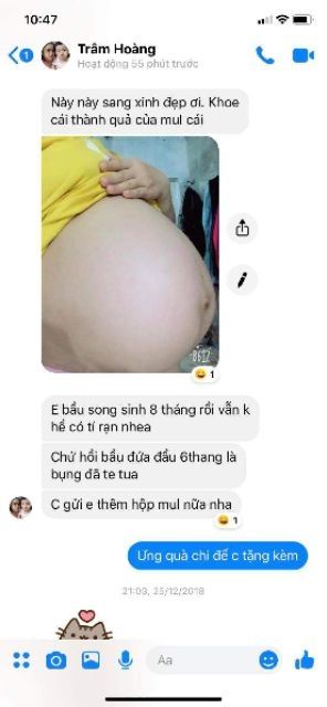 KEM TRI RẠN DA HIÊU QUẢ̉̉̉̉̉̉̉̉̉̉ NHẤ́T HIỆN NAY MUL-ROSE ́́́