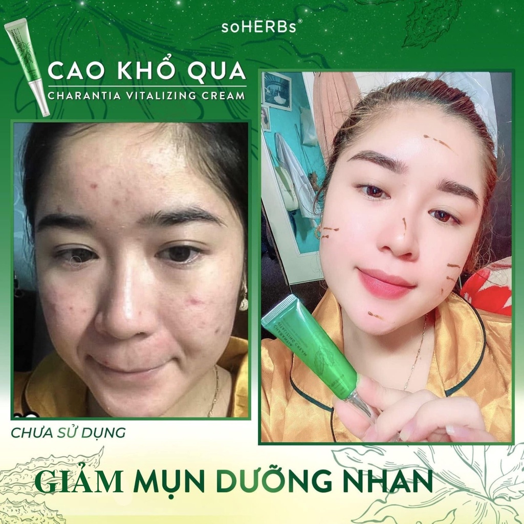 Cao Serum Khổ Qua Dưỡng Da Giảm Mụn Mờ Thâm Soherbs Sirum Mướp Đắng Sạch Mụn , Gel Sữa Rửa Mặt Kiềm Dầu