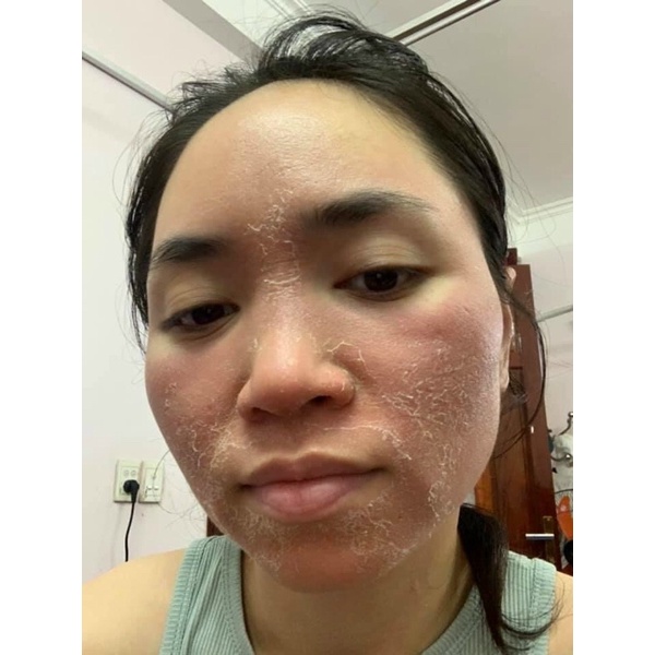 Cốt sâm Spa chuyên mụn , thâm , nám , se khít lỗ chân lông , trắng da handmade