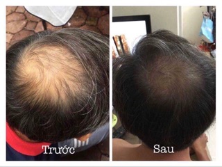 Combo dầu gội bưởi ( lọ to ) + xịt tóc tinh dầu bưởi