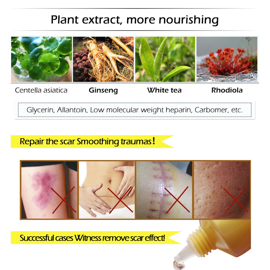 Kem Phục Hồi Sẹo Lõm, Làm Mờ Vết Thâm, Giảm Mụn Bọc Sưng Tấy Đỏ Chiết Suất Tự Nhiên | BigBuy360 - bigbuy360.vn