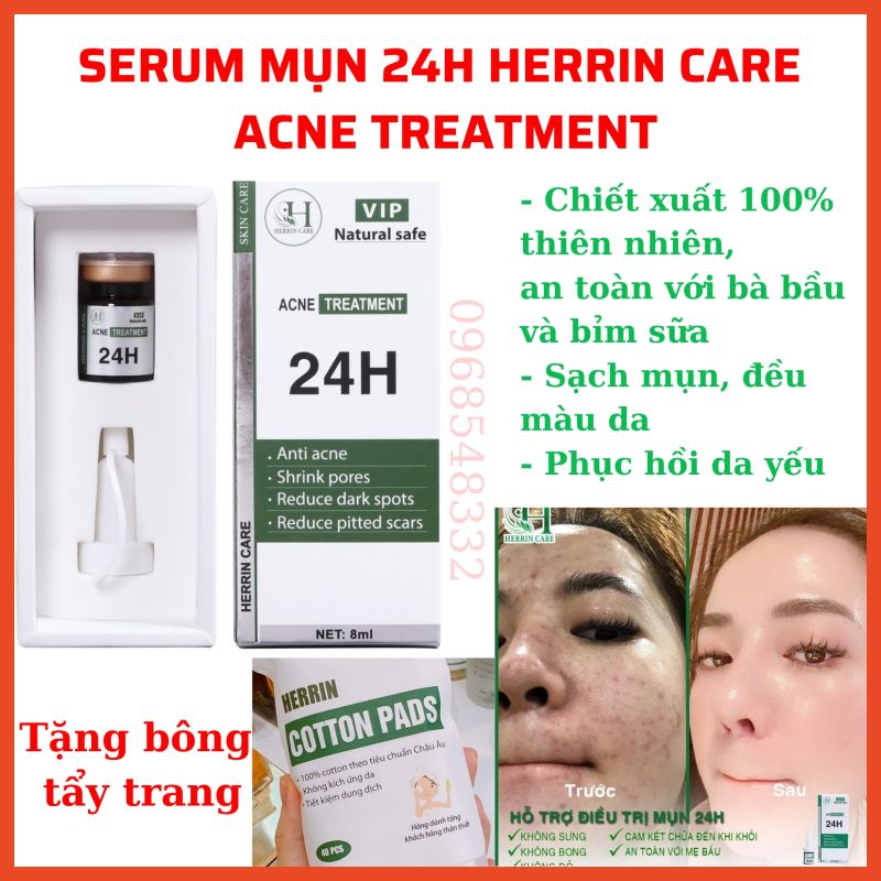 SERUM MỤN 24H HERRIN CARE ĐÁNH BAY TẤT CẢ CÁC LOẠI MỤN-KHÔNG SƯNG-KHÔNG BONG-KHÔNG ĐỎ-8ML | BigBuy360 - bigbuy360.vn