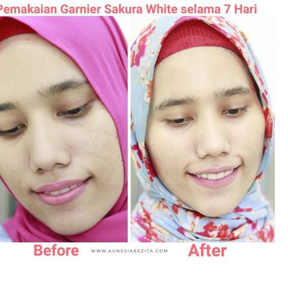 (Hàng Mới Về) Serum Garnier Sakura Làm Trắng Da 20ml..!! > Garnier