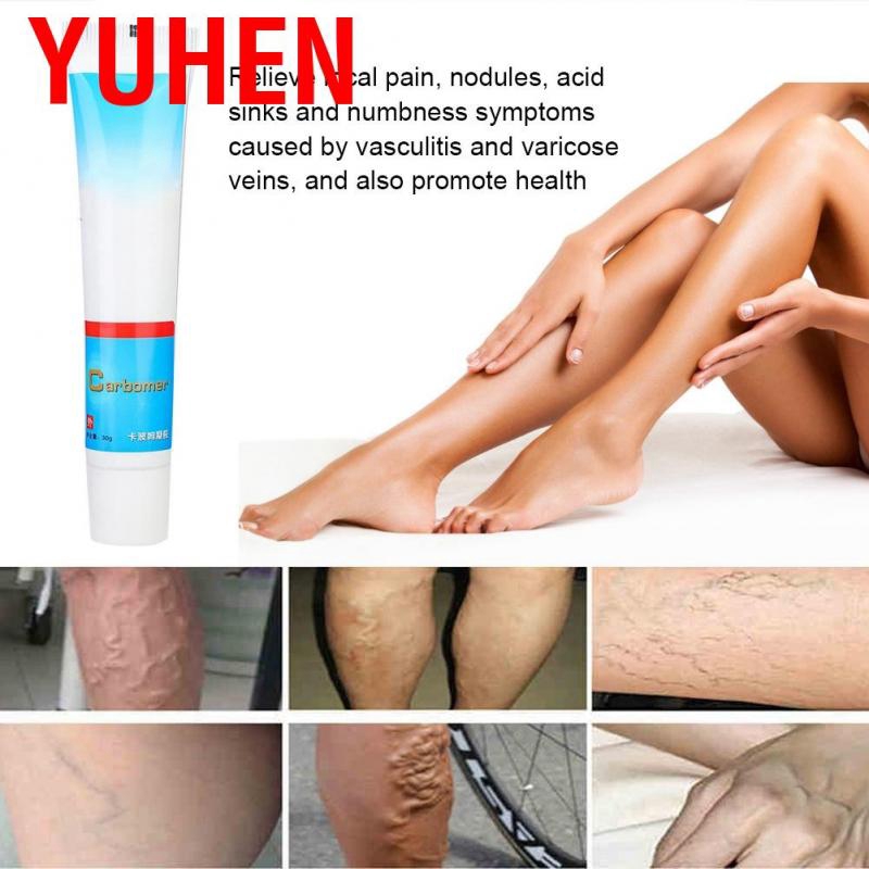 (hàng Mới Về) Thuốc Mỡ hỗ trợ giảm Giãn Tĩnh Mạch An Toàn Và Hiệu Quả