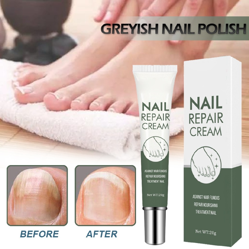 [Hàng mới về] Kem dưỡng phục hồi móng bị hư hỏng mất màu dành cho chăm sóc móng chân 20g