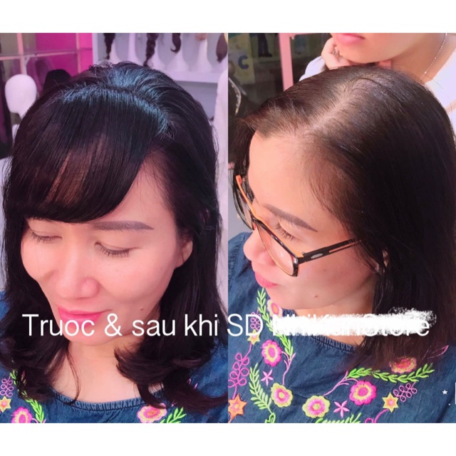 Tóc mái thưa cột❤️freeship 50k tóc che hói cao cấp 3D- hình thật