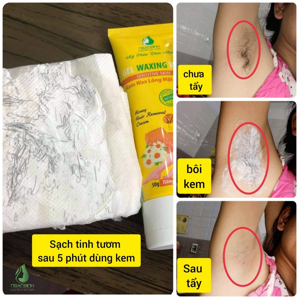 Kem tẩy lông Ngân Bình, kem gel waxing veo làm sạch lông chân, lông tay