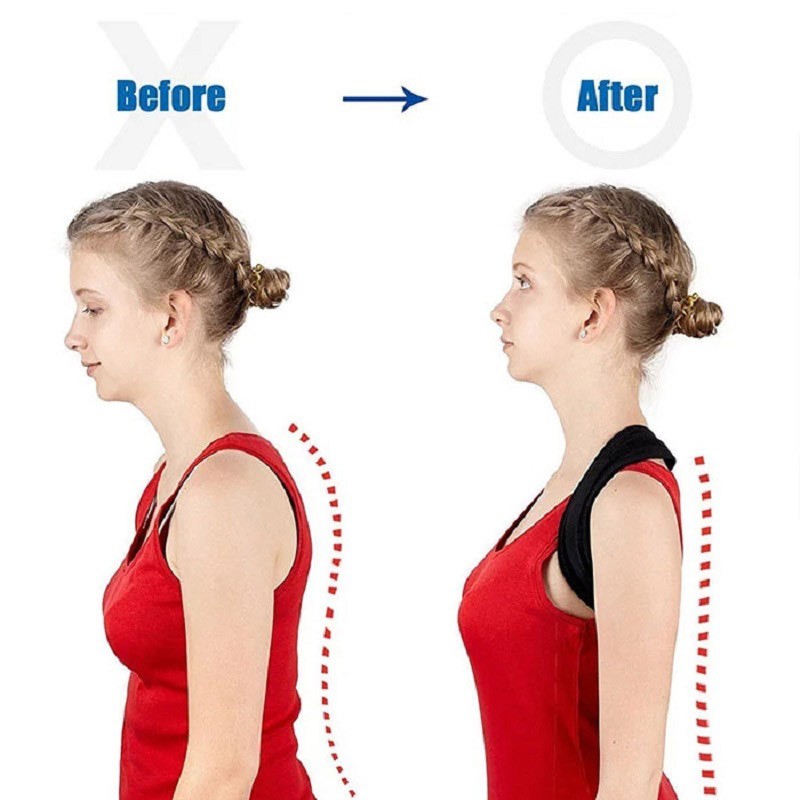 Đai Chống Gù Lưng POSTURE CORRECTOR đóng hộp cao cấp, Đai Chống Gù [Tặng kèm 2 tấm trợ lực]