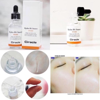 Tinh Chất Làm Trắng, Cấp Ẩm Ciracle Hydra B5 Source Wrinkle 30ml - Miebeauty