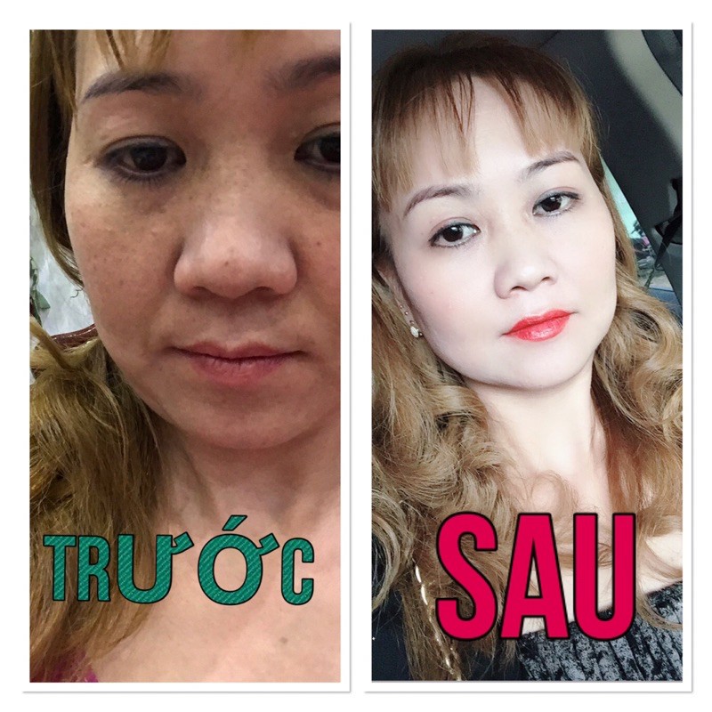 Kem mụn nám dưỡng trắng Beauty Queen 5g