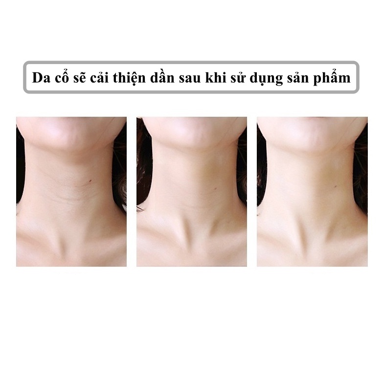 Kem dưỡng trắng vùng da cổ giúp dưỡng ẩm, làm sáng và đều màu da cổ, giảm các vết xỉn màu, ngăn ngừa lão hóa SPT110006
