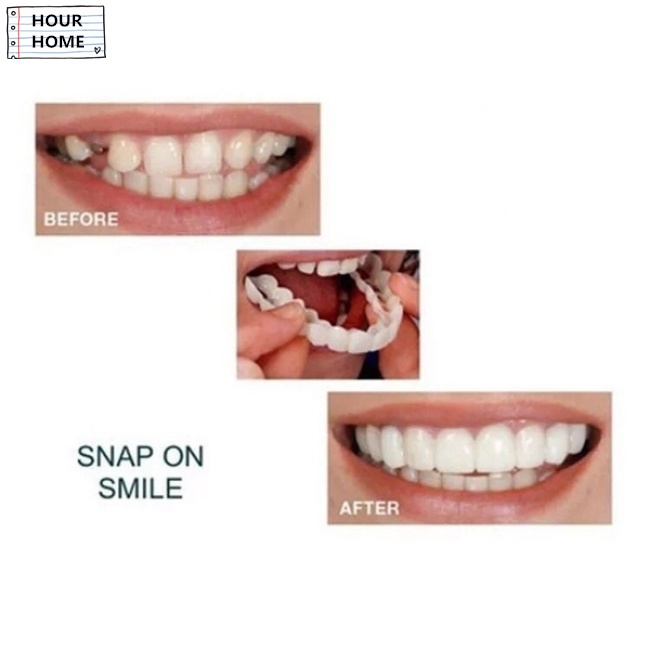 [Hàng mới về] Cặp miếng bọc răng hàm trên và hàm dưới tái sử dụng được đem lại hàm răng trắng sáng