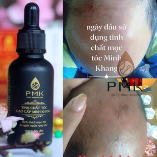 Tinh chất mọc tóc Cao Cấp Phúc Minh Khang