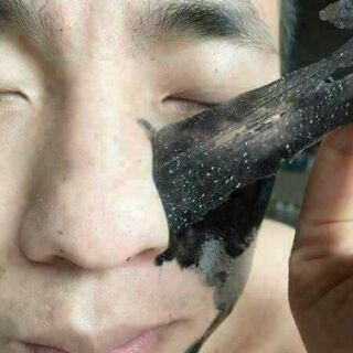 Gel lột mụn than tre