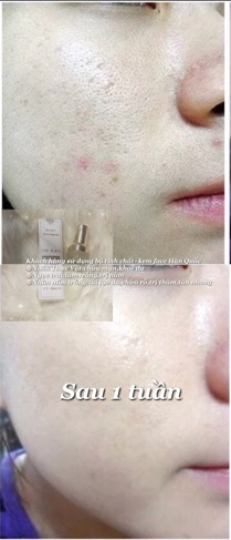 Kem face trắng da Hàn Quốc