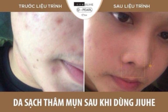 SERUM JIUHE HÀN QUỐC CHÍNH HÃNG MẪU MỚI (HÀNG THANH TÔ)