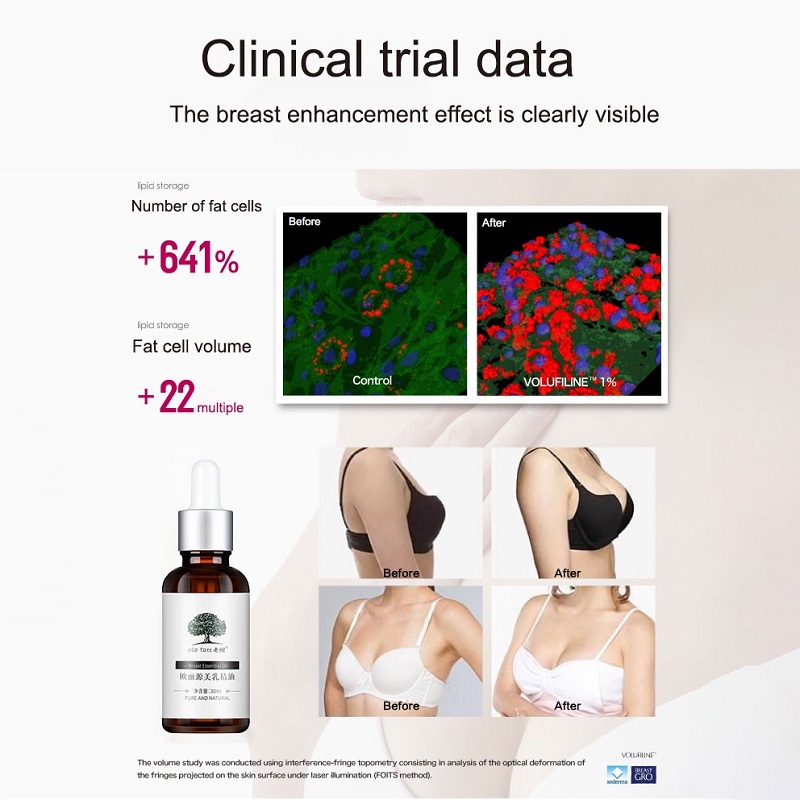 Tinh Dầu Làm Đẹp Ngực Hiệu Ouliyuan | BigBuy360 - bigbuy360.vn