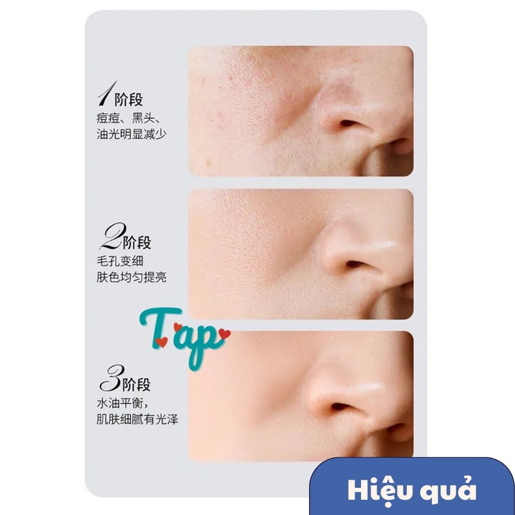 (12 gói) Mặt nạ bùn ốc sên/nha đam thu nhỏ lỗ chân lông làm sáng da