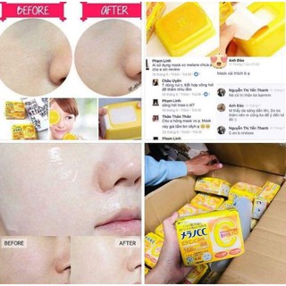 Mặt nạ trắng da