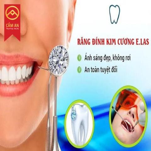 Đá đính răng Kim Cuong Moissanite gắn răn sáng lấp lánh mẫu đế nhọn đẹp bền lâu năm.