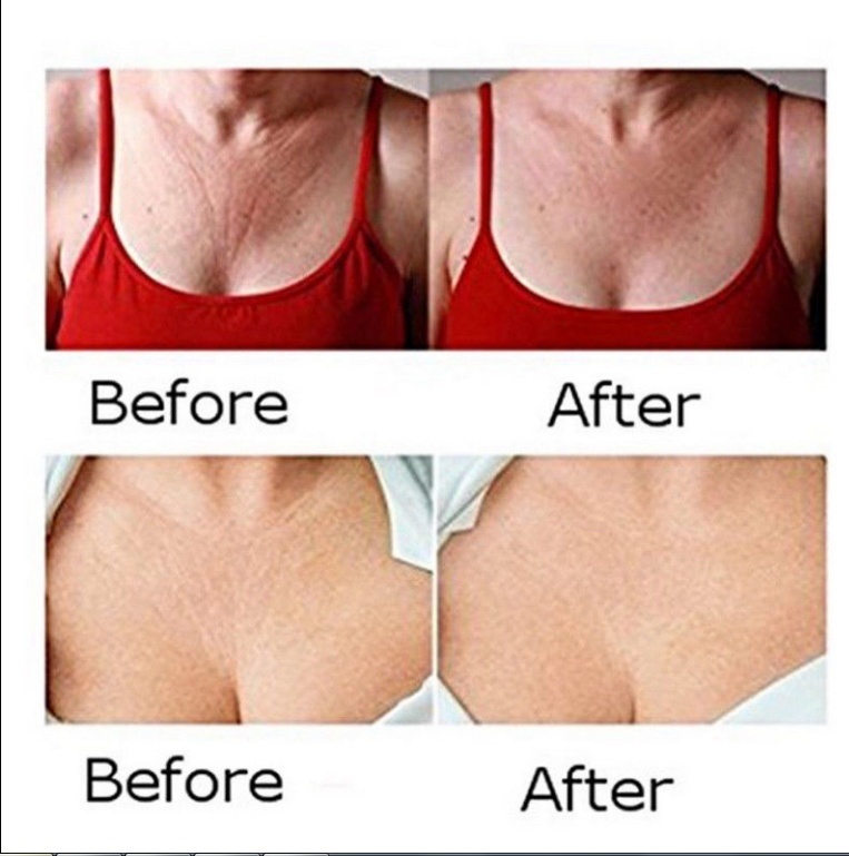 Kem dưỡng da mặt và cổ chống nếp nhăn chứa Peptide | BigBuy360 - bigbuy360.vn