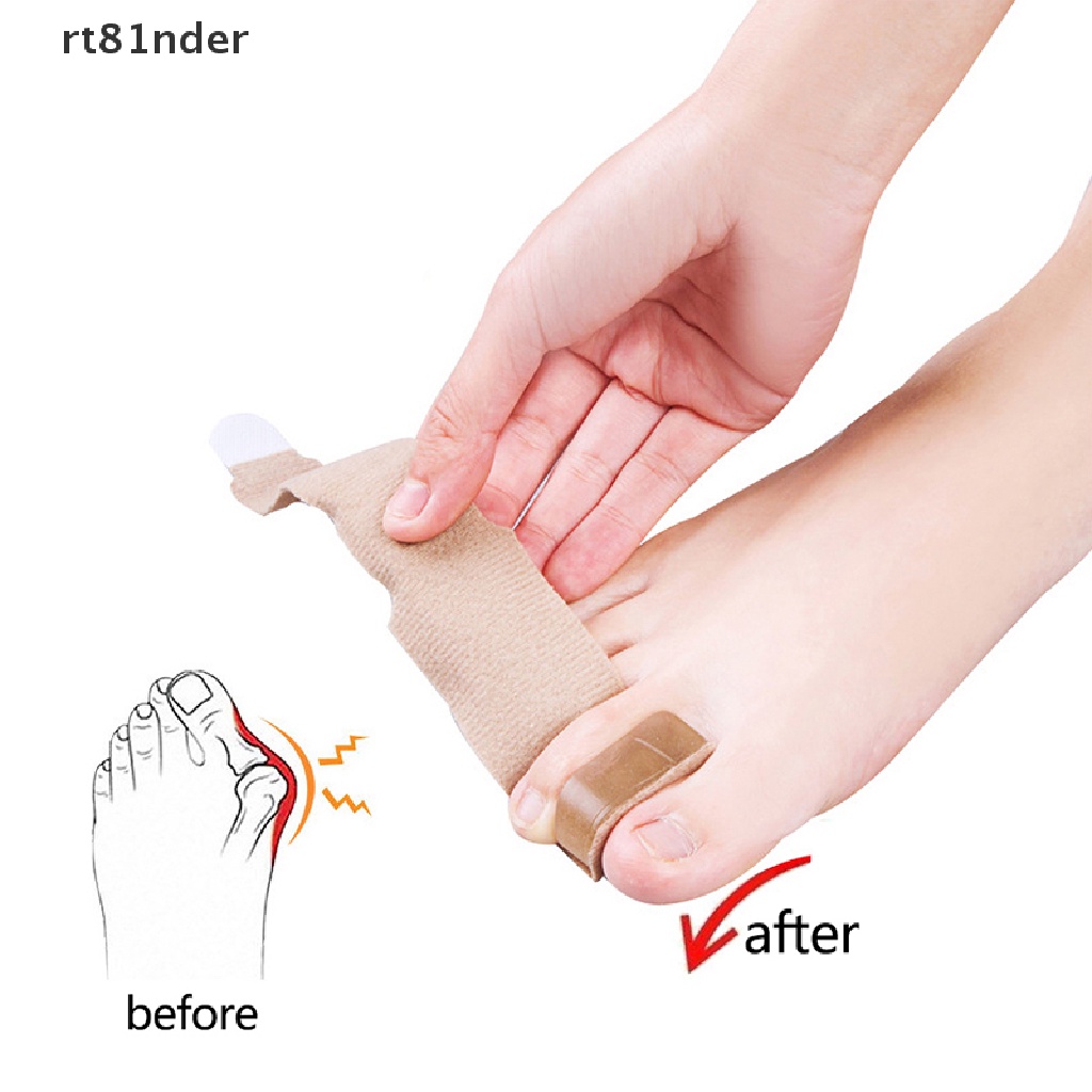 1 Đai Nẹp Chỉnh Hình Ngón Chân Cái