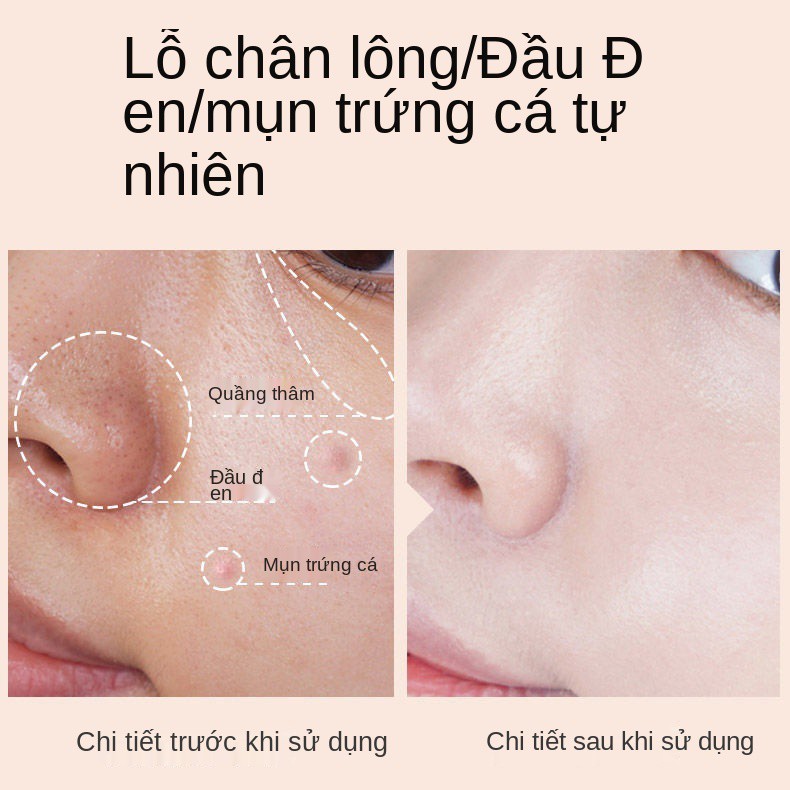 ❄ↂ❣Kem nền BB kháng nước Dưỡng ẩm  che khuyết điểm Meifubao lỏng kiểm soát dầu làm trắng lâu dài, không bột, trang điểm, | BigBuy360 - bigbuy360.vn