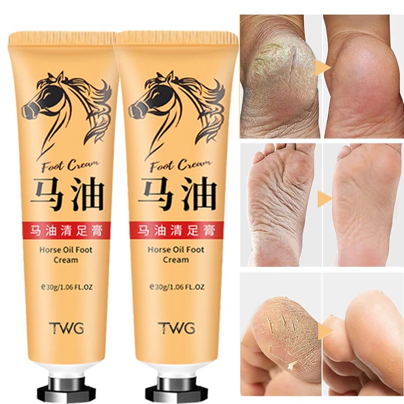 1 Tuýp Kem Dầu Ngựa Trị Nứt Gót Chân Chống Khô Da