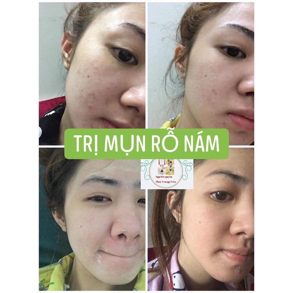 [Mã 2611TIEUDUNG100K giảm 8% đơn 500K] Tái Tạo Da (50ml). | BigBuy360 - bigbuy360.vn