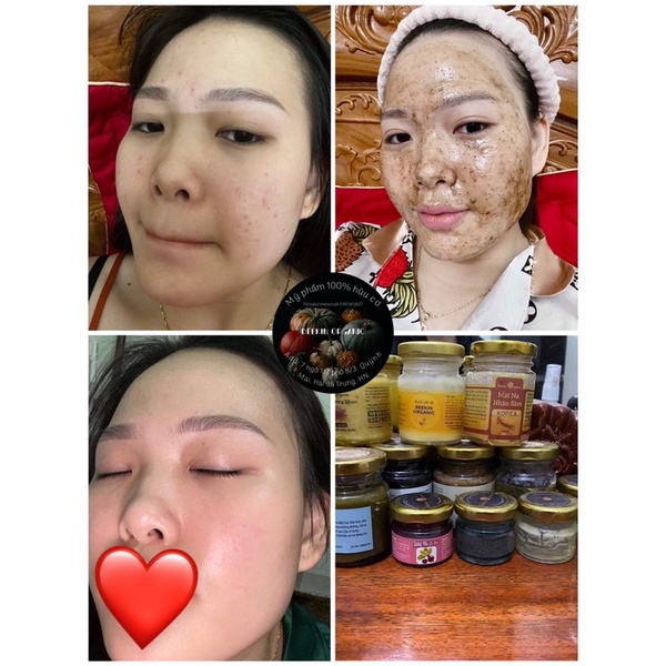 Mặt nạ sữa ong chúa tươi