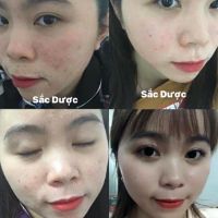 Sắc dược đông y sang sang