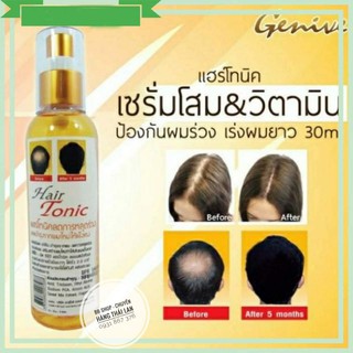 [Hàng Chính Hãng] 01 Chai Xịt Mọc Tóc GENIVE Thái Lan 100ml (Hair Tonic)