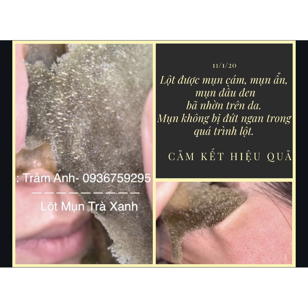 MASK TRÀ XANH LỘT MỤN CỰC XỊN | BigBuy360 - bigbuy360.vn