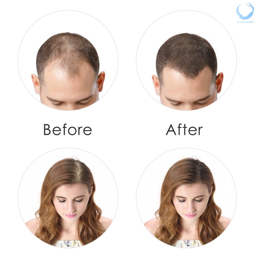 (Hàng Mới Về) Phấn Che Khuyết Điểm Tóc Thưa Ecmall 27.5g 100% Tự Nhiên Cho Nam Nữ | BigBuy360 - bigbuy360.vn
