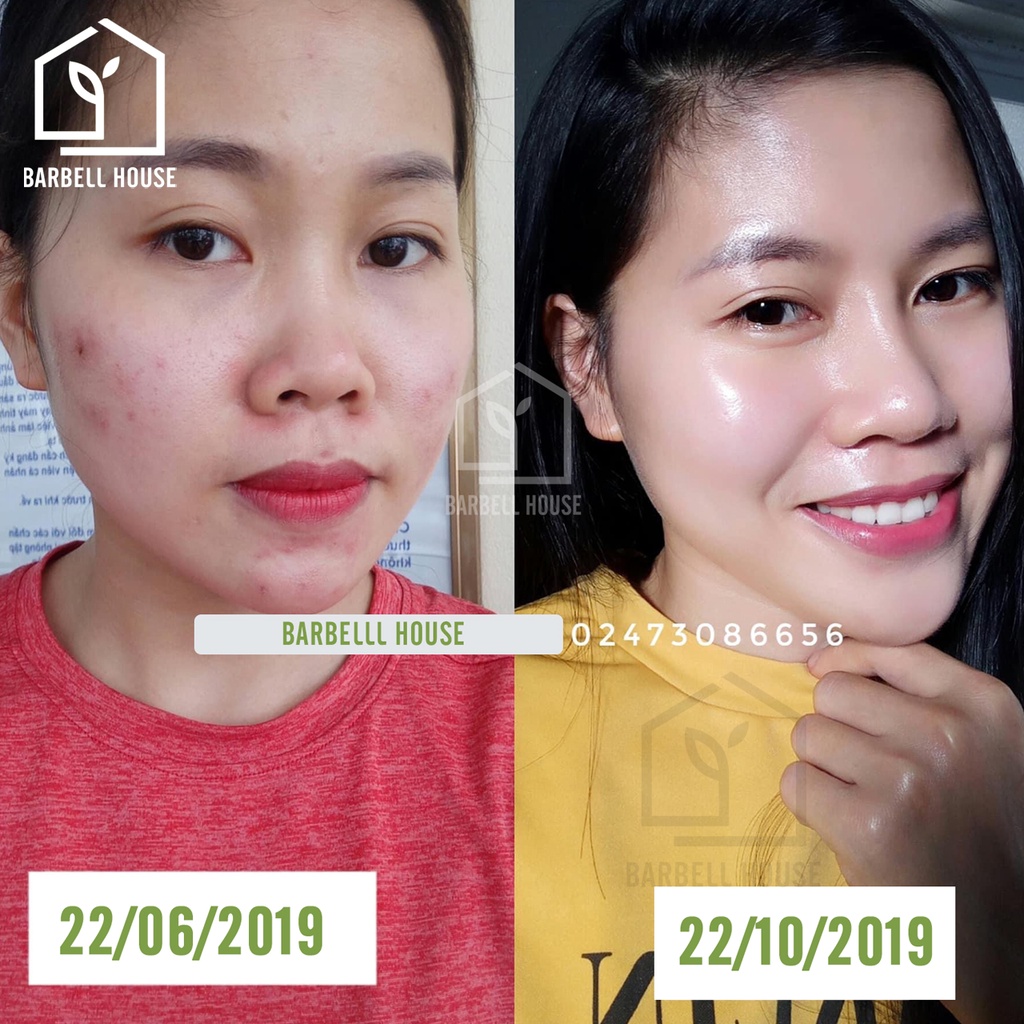 Viên uống đẹp da Collagen thủy phân  - căng sáng da, mờ nám, giảm thâm mụn, chống lão hoá, 180 viên