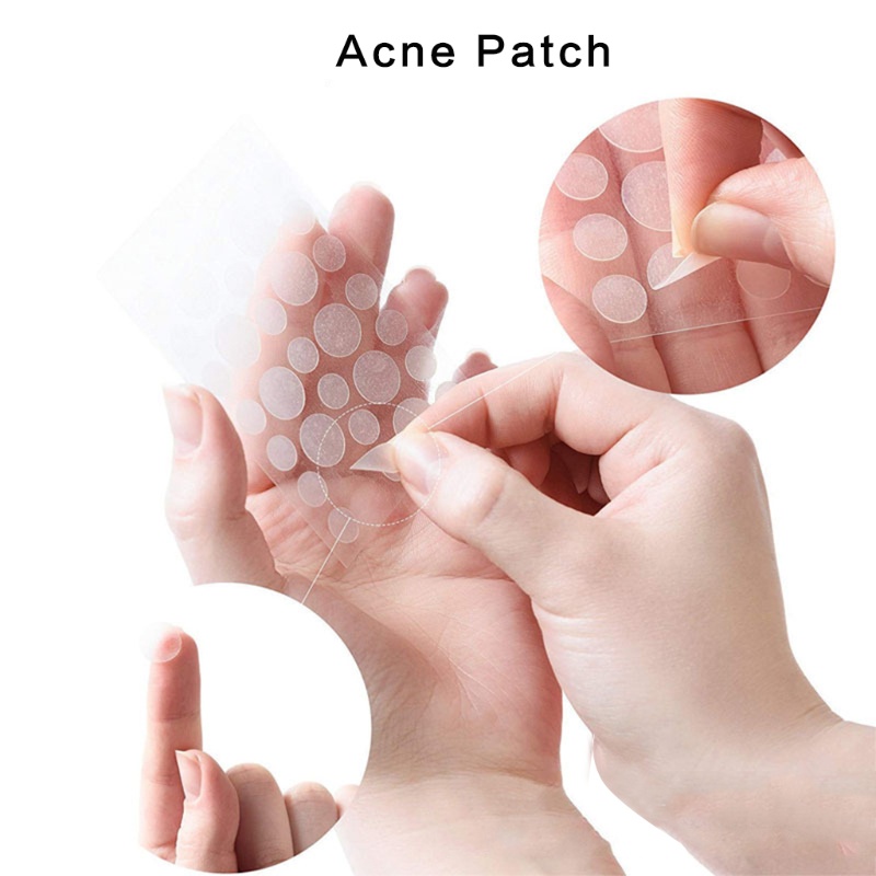 Set 3 Miếng Dán 108 Miếng Dán Mụn Trứng Cá Hấp Thụ Tốt