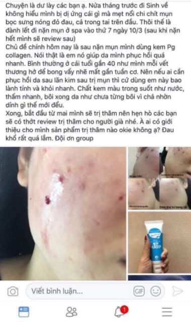 Pg collagen phục hồi da