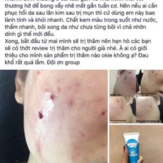 Pg collagen phục hồi da