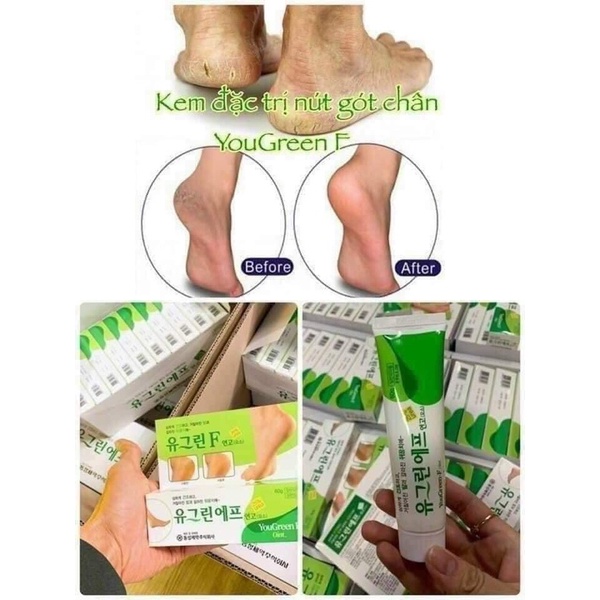 Kem giảm nứt gót chân YouGreen Hàn Quốc 60gr