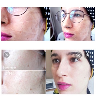 Mặt nạ thạch Celderma Crystal Skin Mask