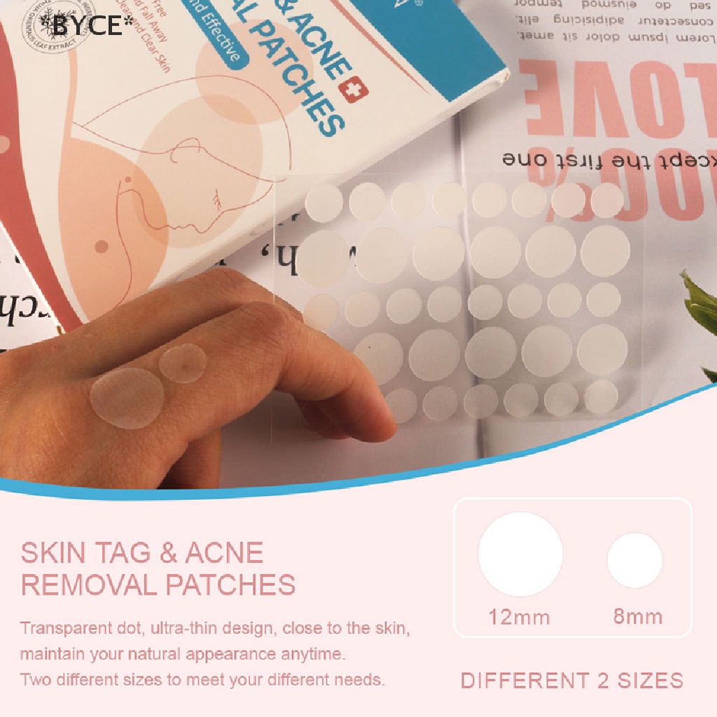 [Hàng mới về] Bộ 108 miếng dán hydrocolloid diệt mụn tiện lợi