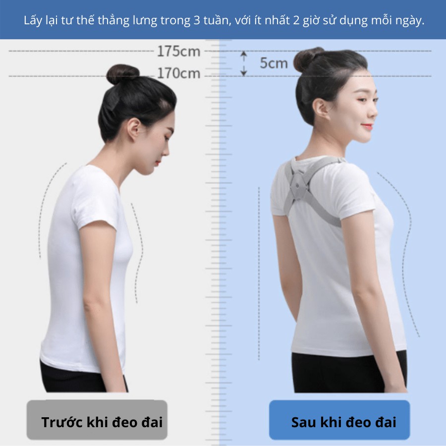 ✈️ [Freeship] Đai chống gù lưng điện tử Hunchback Corrector [Báo rung hiệu quả]