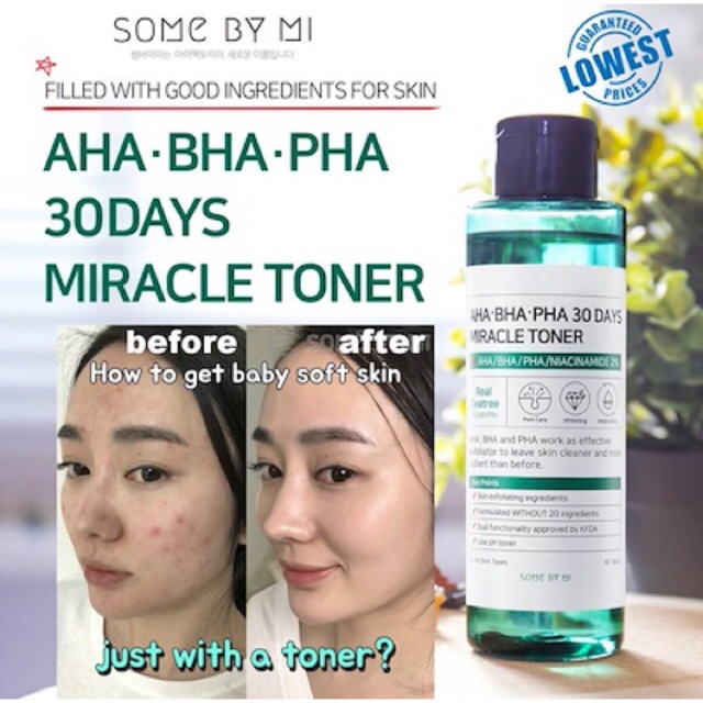 HOT] Nước Hoa Hồng "Thần Kỳ" Some By Mi AHA-BHA-PHA 30 Days Miracle Toner 150ml [Trị Sạch Mụn Chỉ Trong 30 Ngày]