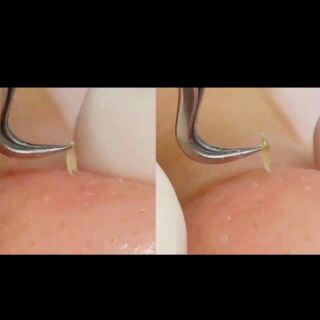 Chuốt tóc con