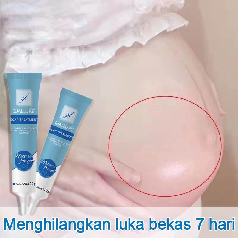 Kem Mờ Sẹo Mờ Thâm Peimei Kem Giảm Sẹo Và Rạn Da - Chống Sẹo Lồi Sẹo Lõm Hiệu Quả Sau 1 Tuần Scar Remover Kem Làm Mờ Rạn