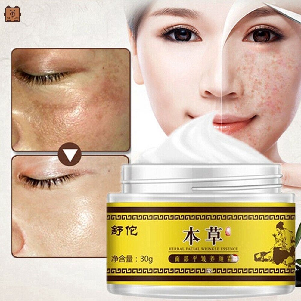 [Hàng mới về] Kem xóa tàn nhang 30g làm trắng phục hồi và chăm sóc da hiệu quả