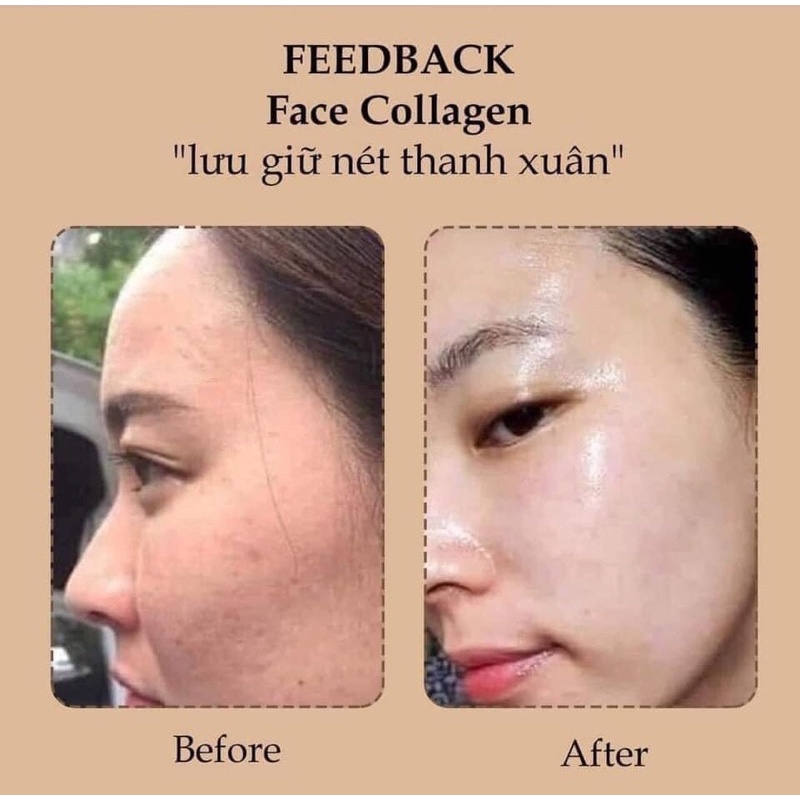 Kem Face Collagen Dna Cá Hồi