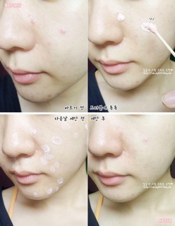 Lotion Chấm Mụn Bye Bye Blemish - Mỹ