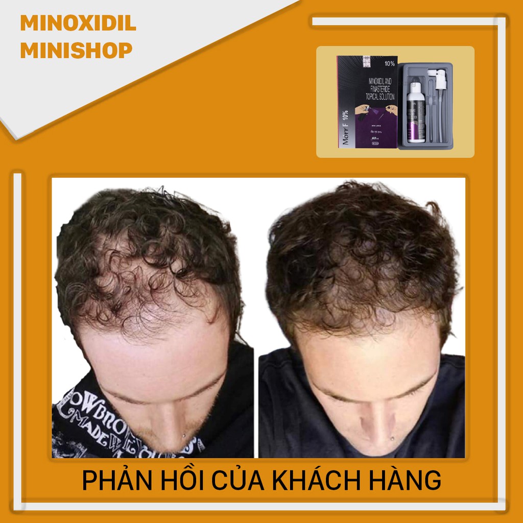 Morr F10% - Thuốc mọc tóc Minoxidil & Finasteride 10% - Morr F10