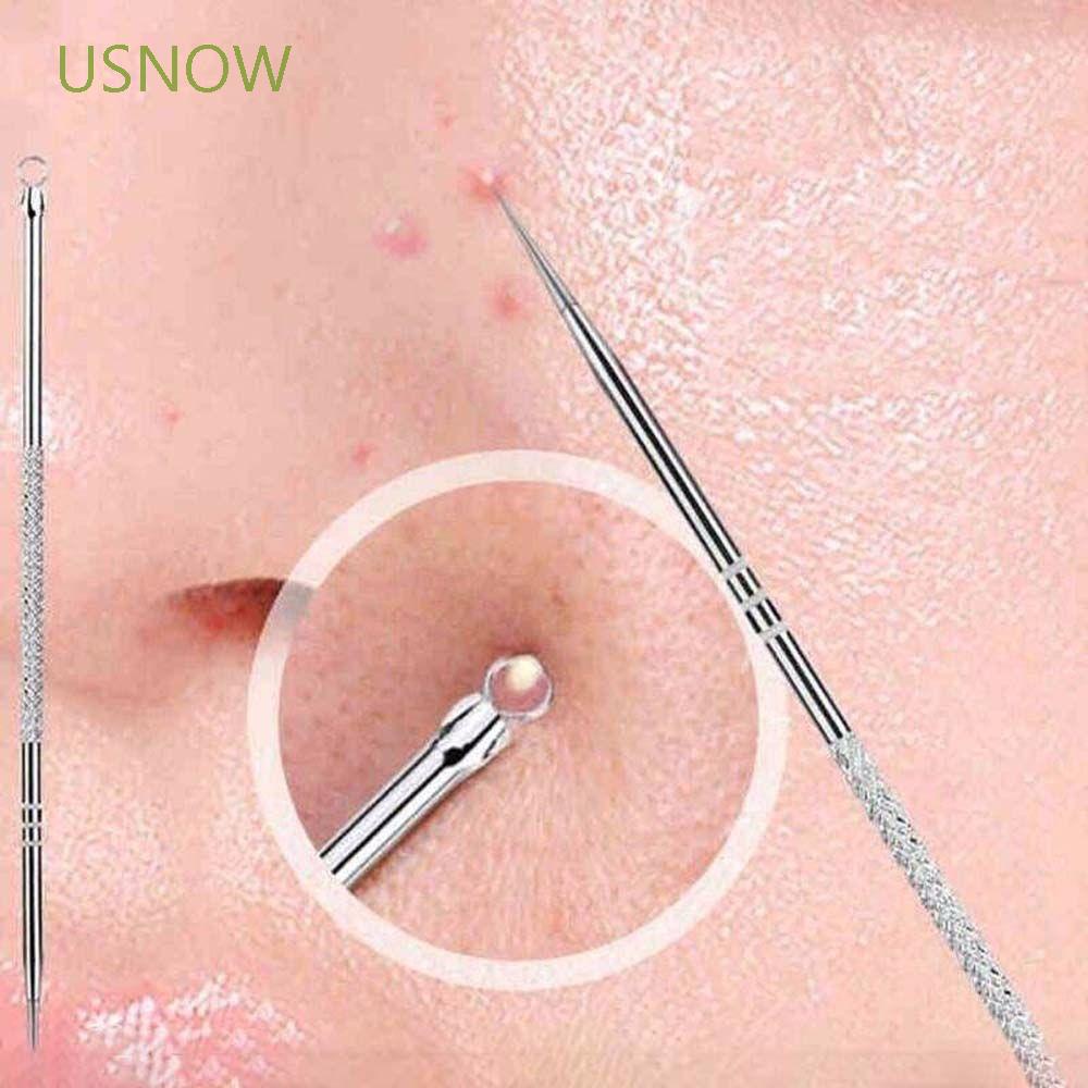 [Hàng mới về] Cây Nặn Mụn Đầu Đen 12 cm Bằng Thép Không Gỉ Chuyên Dụng Tiện Lợi